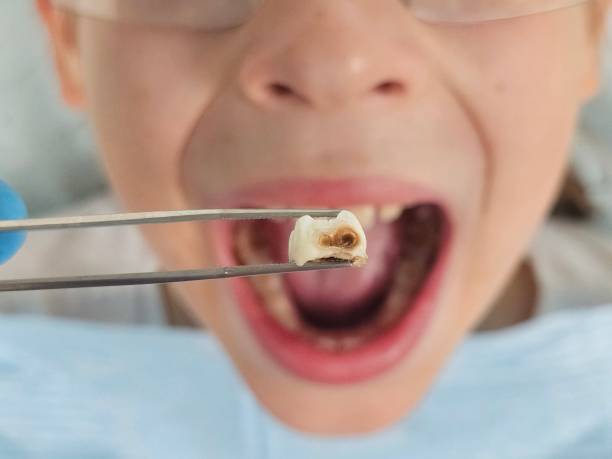 Best Same-Day Emergency Dentist in Pleasanton, CA